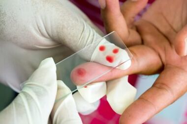 Diagnosis of joint pain on the fingers