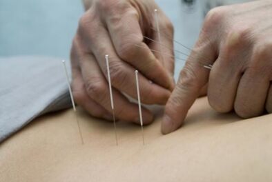 Acupuncture in osteochondrosis of the chest