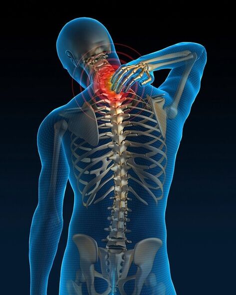 In the initial stage of treatment of cervical osteochondrosis, neck pain increases